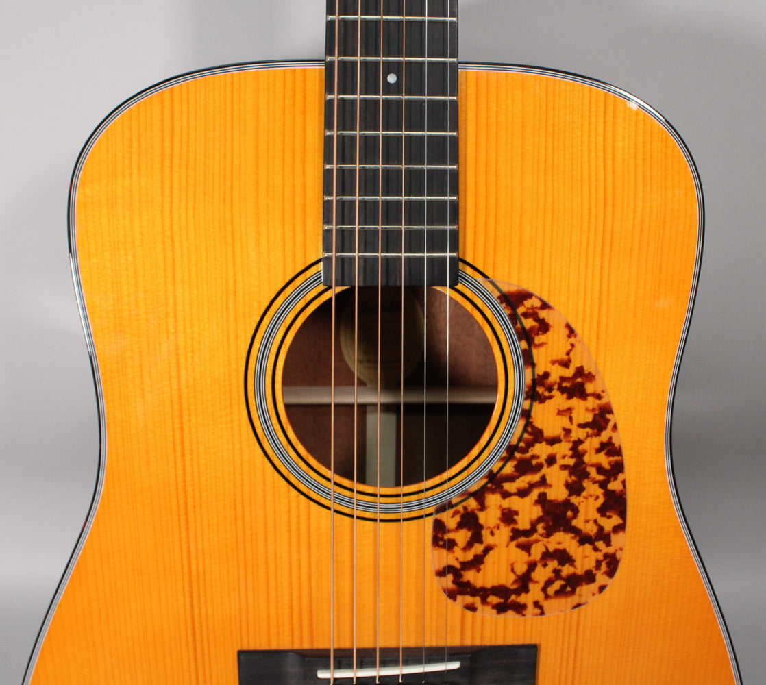 Full front view of a light orange acoustic guitar with a tortoiseshell pickguard and black fretboard.